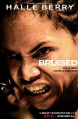 ნატკენი / Bruised